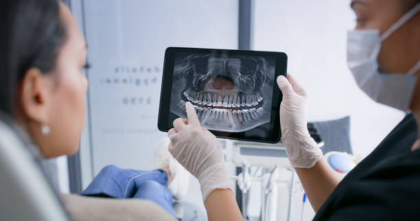 Licensed Teeth Whitening service in Berwick, LA - Smile Center Dentistry